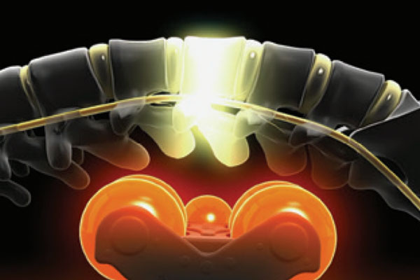 気になる部位を集中攻略「マスターモード」